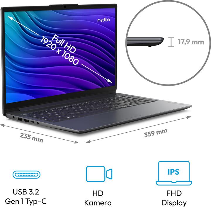 Actual product image Medion E15235 (MD62610), dark grey (15.59", Intel Core i3-N305, 8 GB, 512 GB, Eng. Int.)