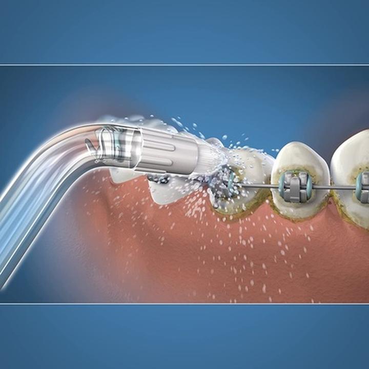 Produktbild Waterpik Whitening Orthodontic Düsen
