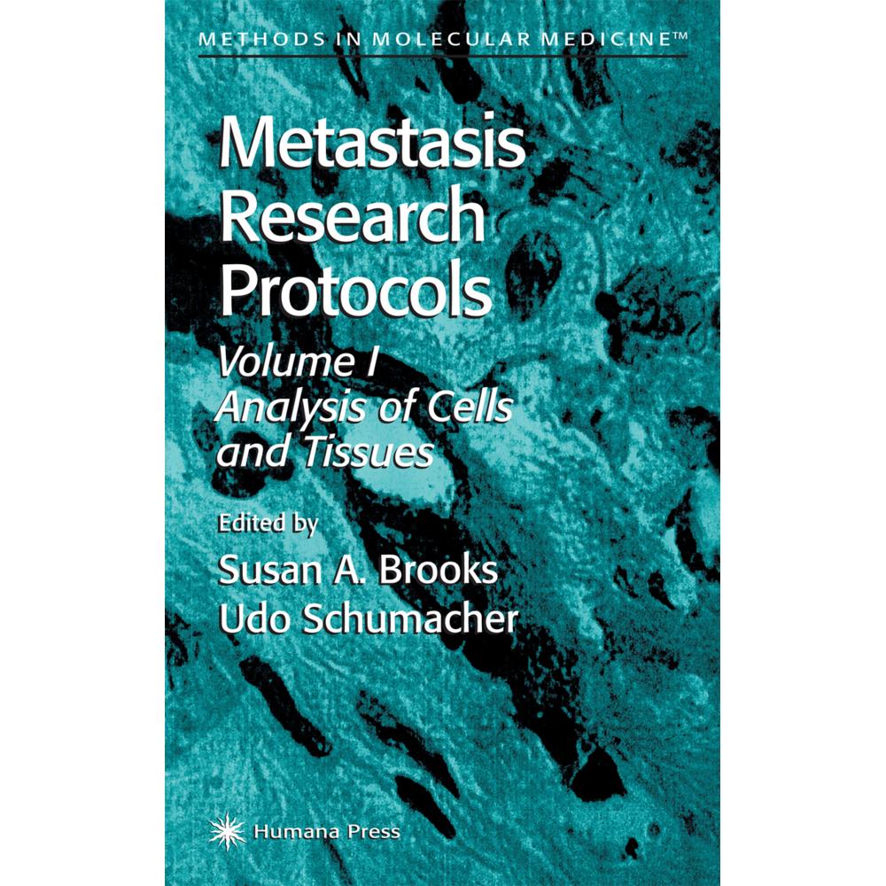 Metastasis Research Protocols, Fachbücher von Udo Schumacher, Susan A. Brooks