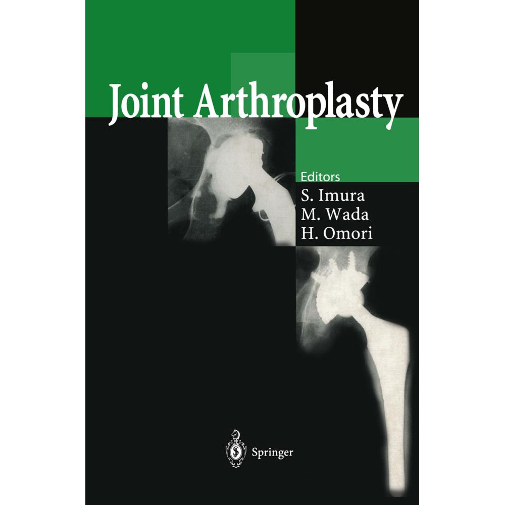 Thumbnail - Joint Arthroplasty, Fachbücher von Shinichi Imura, Hironori Omori, Makoto Wada