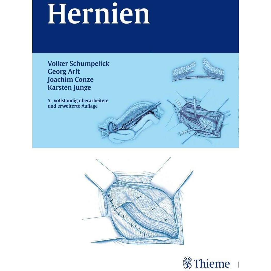 Hernien, Fachbücher von Volker Schumpelick, Klaus Joachim Conze, Karsten Junge, Georg Arlt