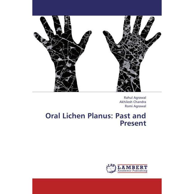 Oral Lichen Planus: Past and Present, Fachbücher von Akhilesh Chandra, Romi Agrawal, Rahul Agrawal