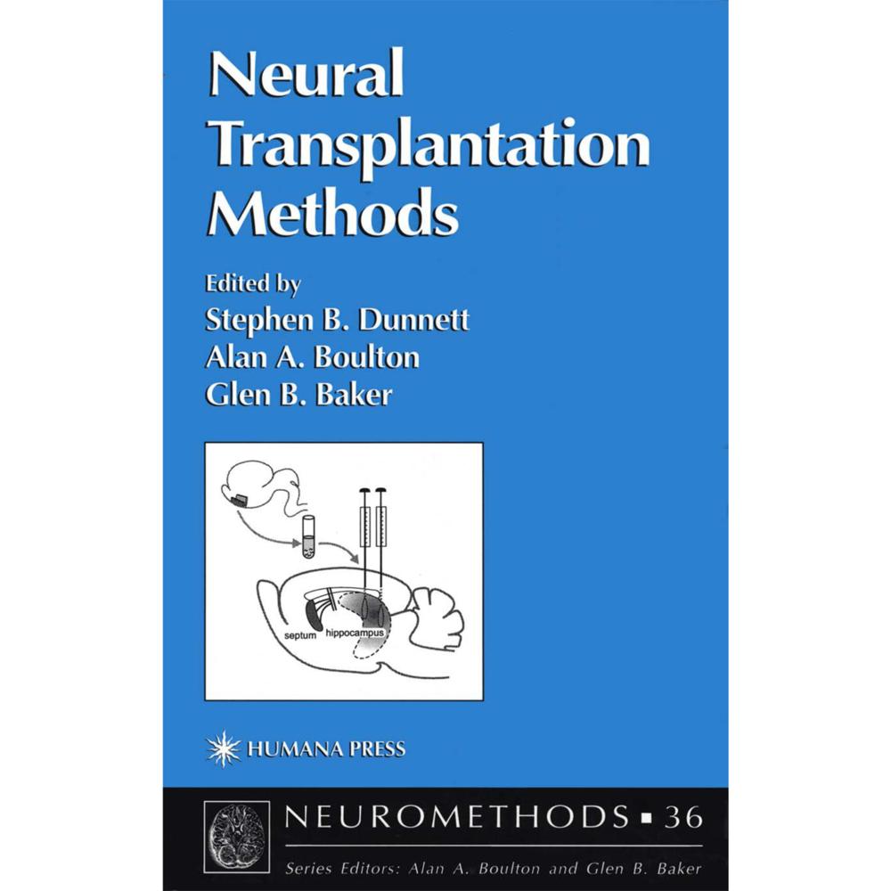 Neural Transplantation Methods, Fachbücher von Glen B. Baker, Alan A. Boulton, Stephen B. Dunnett