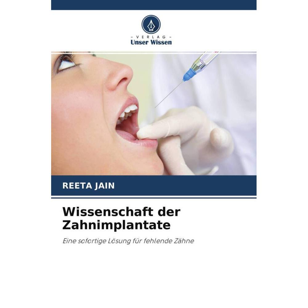 Wissenschaft der Zahnimplantate, Fachbücher von Reeta Jain