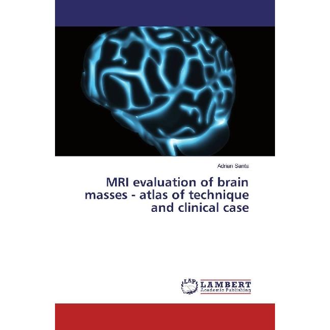 MRI evaluation of brain masses - atlas of technique and clinical case, Fachbücher von Adrian Santa