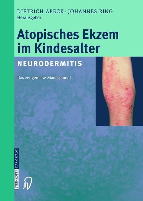 Produktbild Atopisches Ekzem im Kindesalter (Neurodermitis) (Deutsch, D. Abeck, J. Ring, 2014)