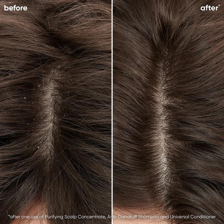 Actual product image Biolage Universal Conditioner for All Hair Types with Fermented Tea and Glycolic Acid 200ml (200 ml)