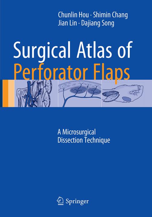 Surgical Atlas of Perforator Flaps (Englisch, Chunlin Hou, Dajiang Song, Jian Lin, Shimin Chang, 2016)