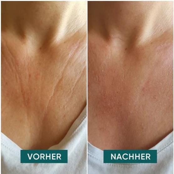 Produktbild Apricot Dekolleté-Pad mit Hyaluron (90 ml)