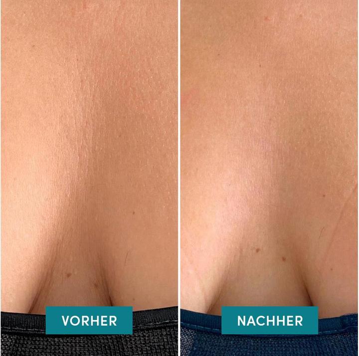 Actual product image Apricot wiederv Dekol Pad one calm away (42.04 ml)