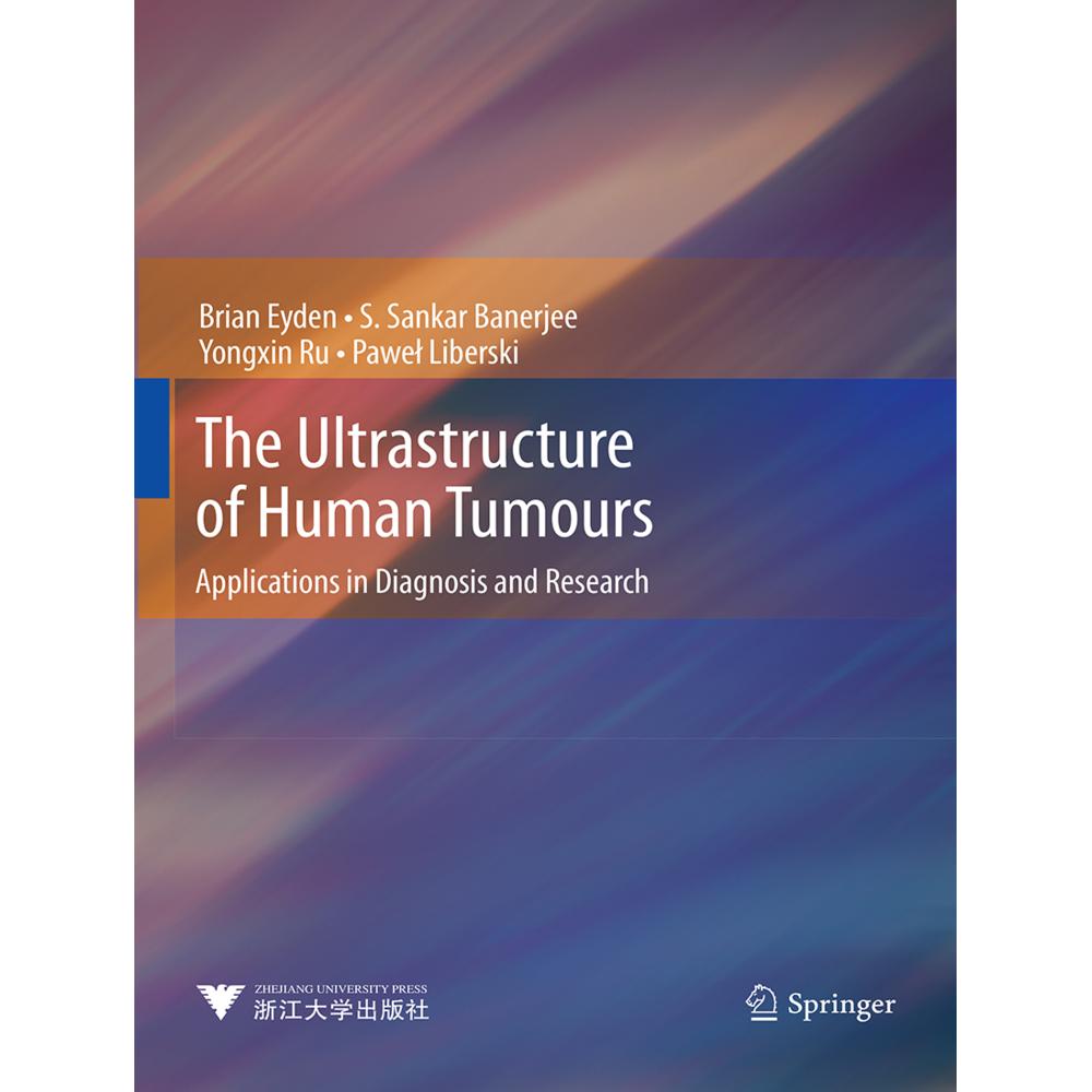 The Ultrastructure of Human Tumours, Fachbücher von Yongxin Ru, Pawel Liberski, Brian Eyden, S. Sankar Banerjee