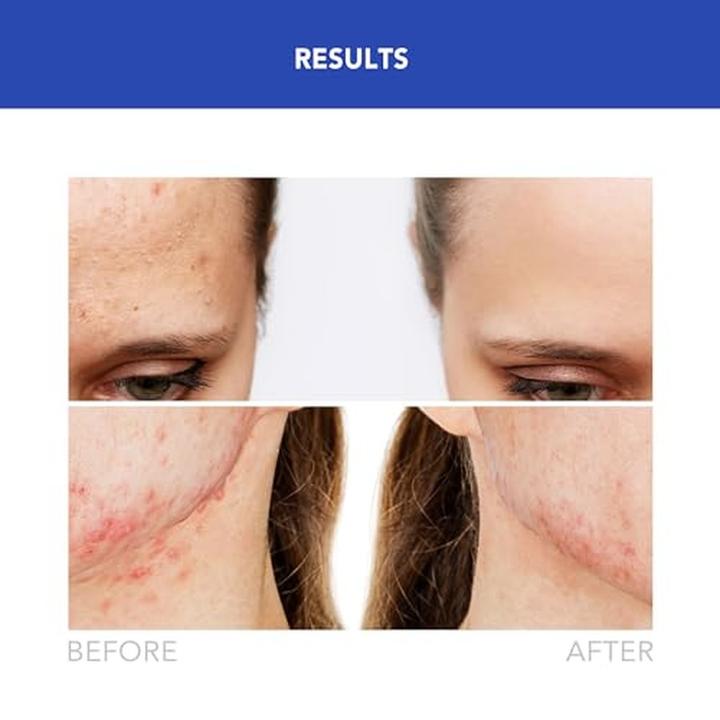 Produktbild Foreo ESPADA 2 Cobalt Blue