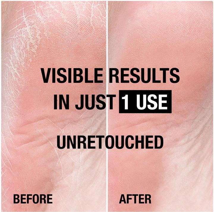 Actual product image Neutrogena Norwegian FormulaÂ® Intense Repair Foot Cream (Foot cream & foot gel, 50 ml)