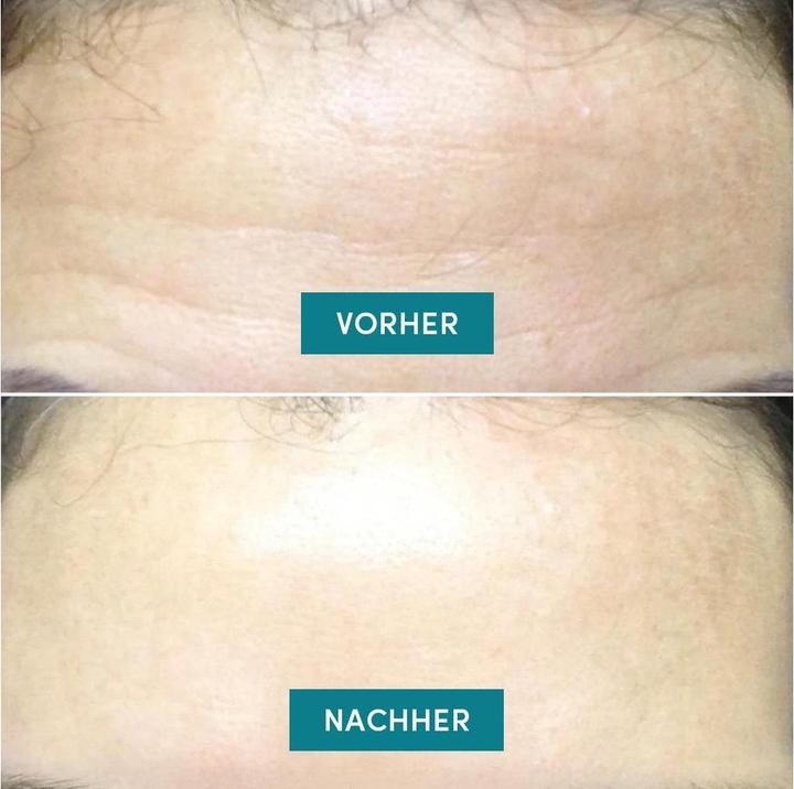 Produktbild Apricot Anti-Aging-Pad