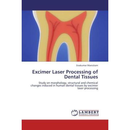 Excimer Laser Processing of Dental Tissues, Fachbücher von Sivakumar Manickam