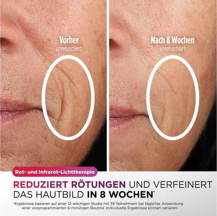 Actual product image Shark CryoGlow LED mask + FW312EUPL