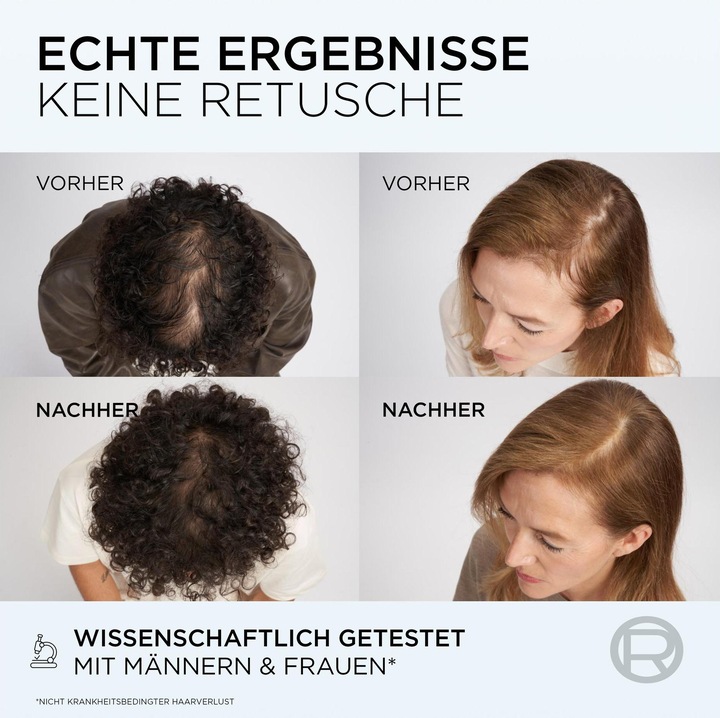 Image du produit L'Oréal Paris Booster de fibre Elseve (102 ml)