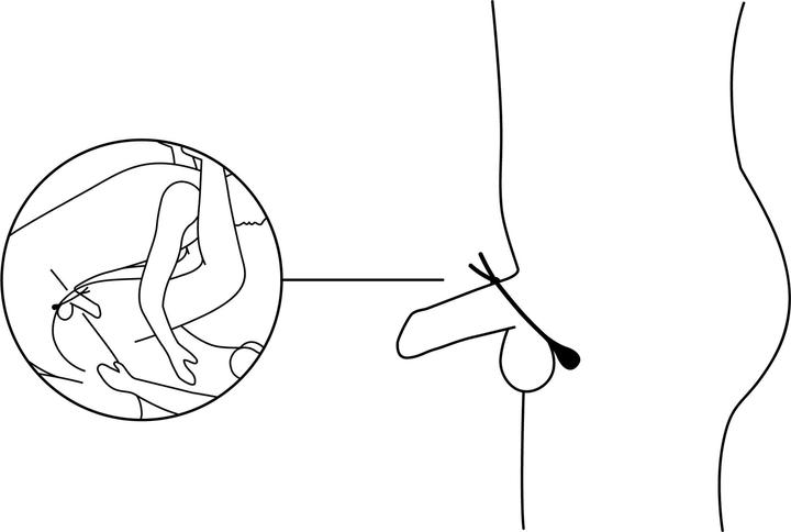 Produktbild Nexus Forge Vibrations Lasso Penisring (4 cm)