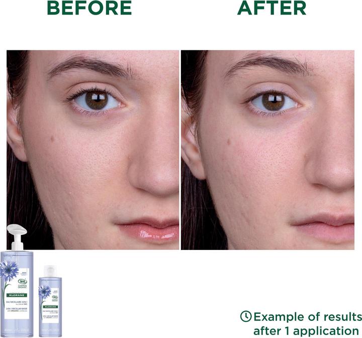 Image du produit Klorane Lotion micellaire 3 en 1 au bleuet bio (Eau micellaire, 100 ml)