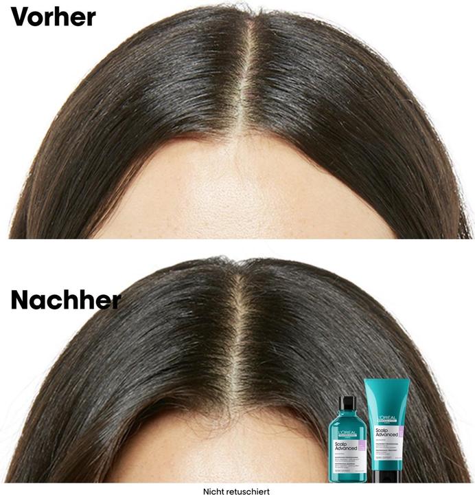 Produktbild L'Oréal Professionnel Série Expert Scalp Advanced - Anti-Discomfort Dermo-Regulator (300 ml, Flüssiges Shampoo)