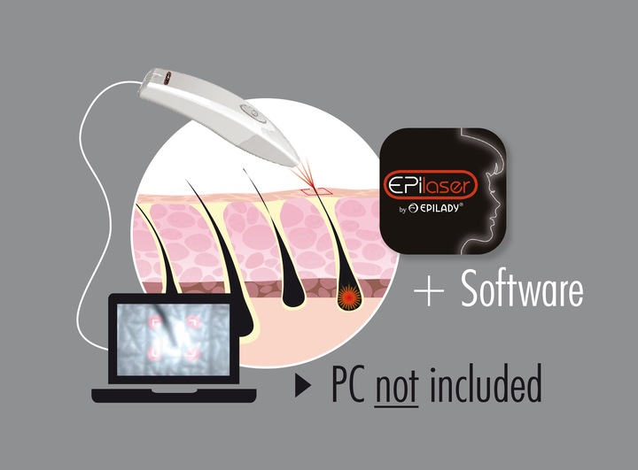 Actual product image Trisa Epilaser