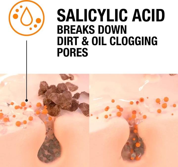 Actual product image Neutrogena Schwarzkopf, Peeling against Wągrom, 150 ml (Cleansing scrub, 150 ml)