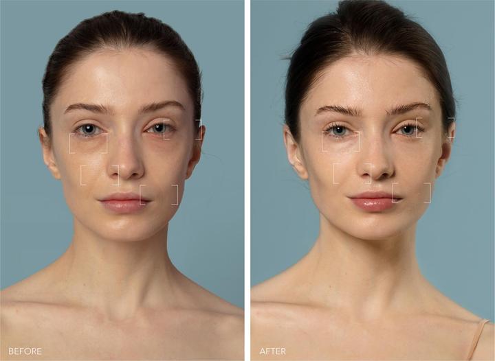 Produktbild Foreo Ufo 3