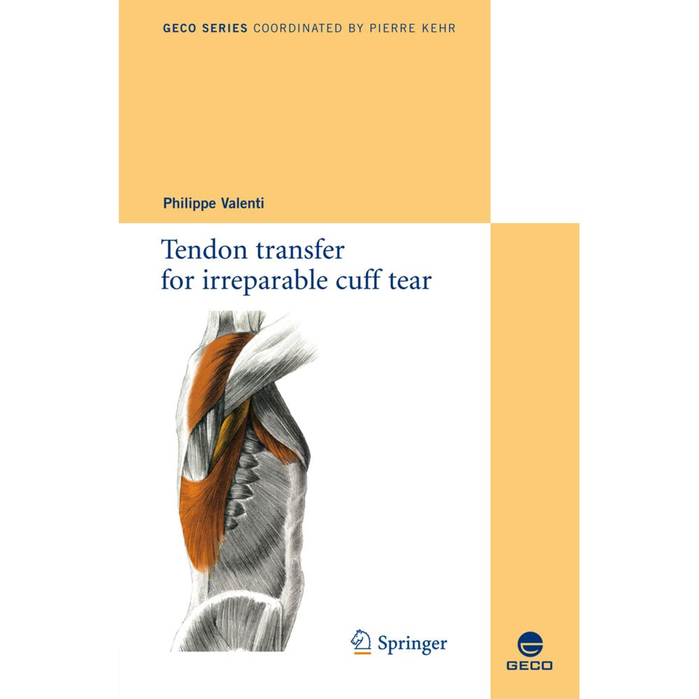 Tendon transfer for irreparable cuff tear, Fachbücher