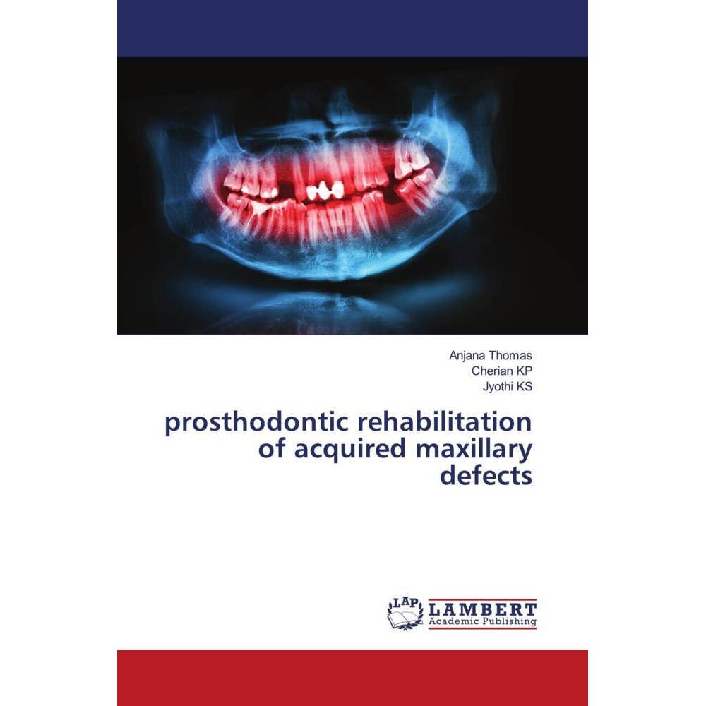 prosthodontic rehabilitation of acquired maxillary defects, Fachbücher von Cherian KP, Anjana Thomas, Jyothi KS
