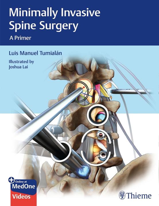 Tumialan:Minimally Invasive Spine Surge (Englisch, Luis Manuel Tumialan, 2020)