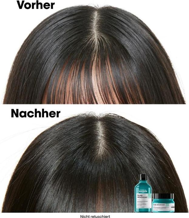 Produktbild L'Oréal Professionnel Scalp Advanced (250 ml)