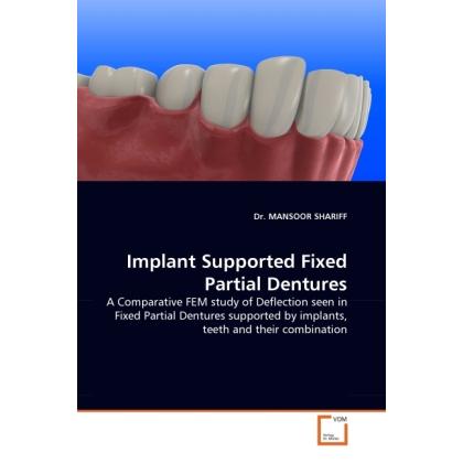 Implant Supported Fixed Partial Dentures, Fachbücher von Mansoor Shariff