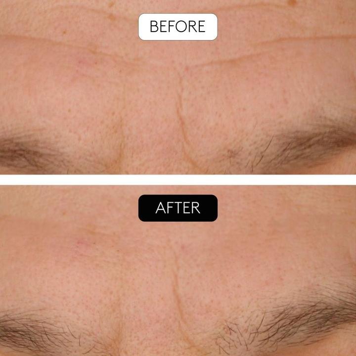 Produktbild Cocunat Clinical Beauty Filler - 5 Ml (5 ml)