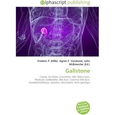 Gallstone, Fachbücher von Frederic P. Miller, Agnes F. Vandome, John McBrewster