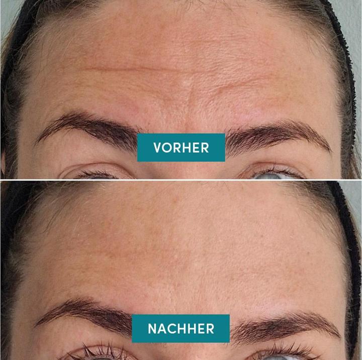 Immagine prodotto Apricot Forehead Pad