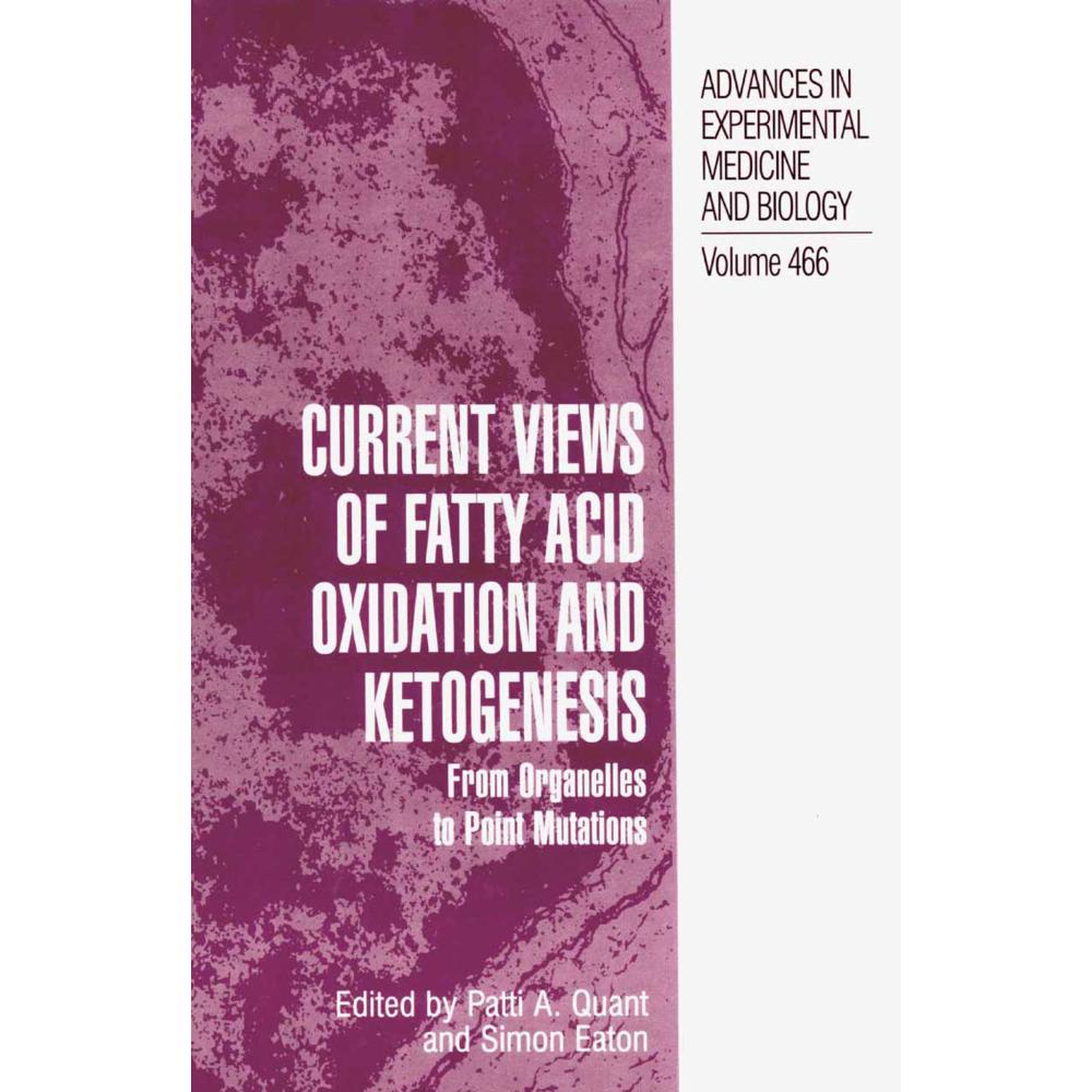 Current Views of Fatty Acid Oxidation and Ketogenesis, Fachbücher von Patti A. Quant, Simon Eaton