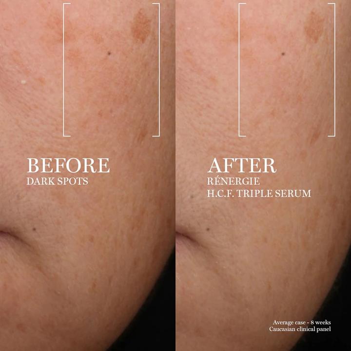 Produktbild Lancôme Rénergie Triple Serum (50 ml)