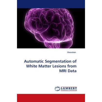 Automatic Segmentation of White Matter Lesions from MRI Data, Fachbücher von Shenshen