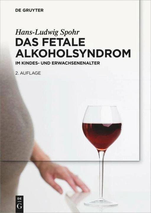 Produktbild Das Fetale Alkoholsyndrom (Deutsch, Florian Heinen, Gela Becker, Hans-Ludwig Spohr, Heike Wolter, Mirjam Landgraf, 2016)