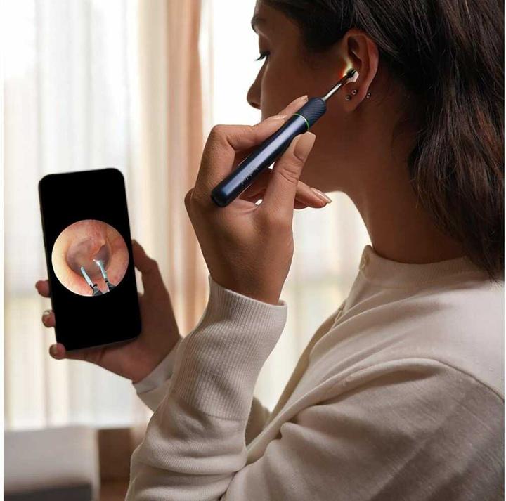 Actual product image Bebird Ear cleaner