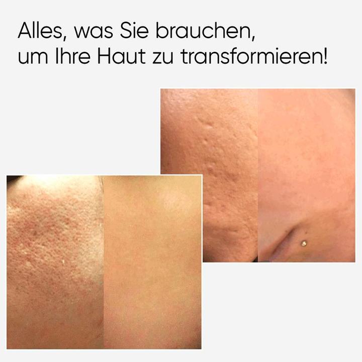 Produktbild Âme pure CIT Face Roller