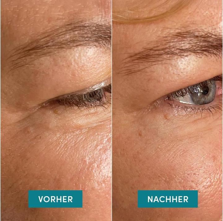 Produktbild Apricot wiederv Augenschl Pad aloe the 2 (Augenpatches, 21.67 ml)