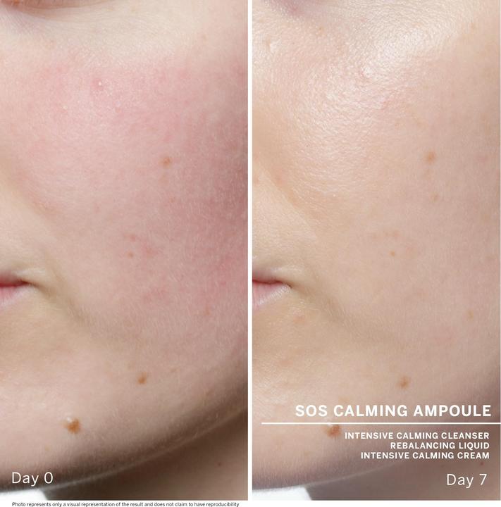 Image du produit Babor AMPOULE CONCENTRATES - SOS Calming (14 ml)