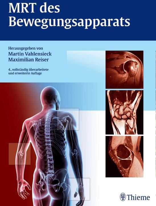Produktbild MRT des Bewegungsapparats (Deutsch, Martin Vahlensieck, Maximilian Reiser, 2014)