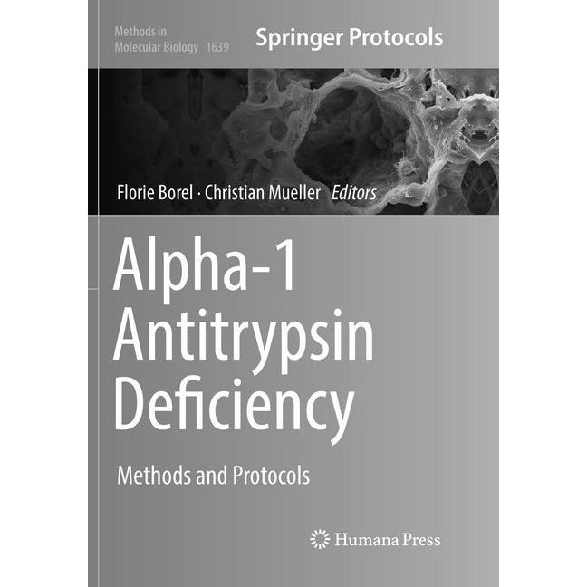 Alpha-1 Antitrypsin Deficiency, Fachbücher von Christian Mueller, Florie Borel
