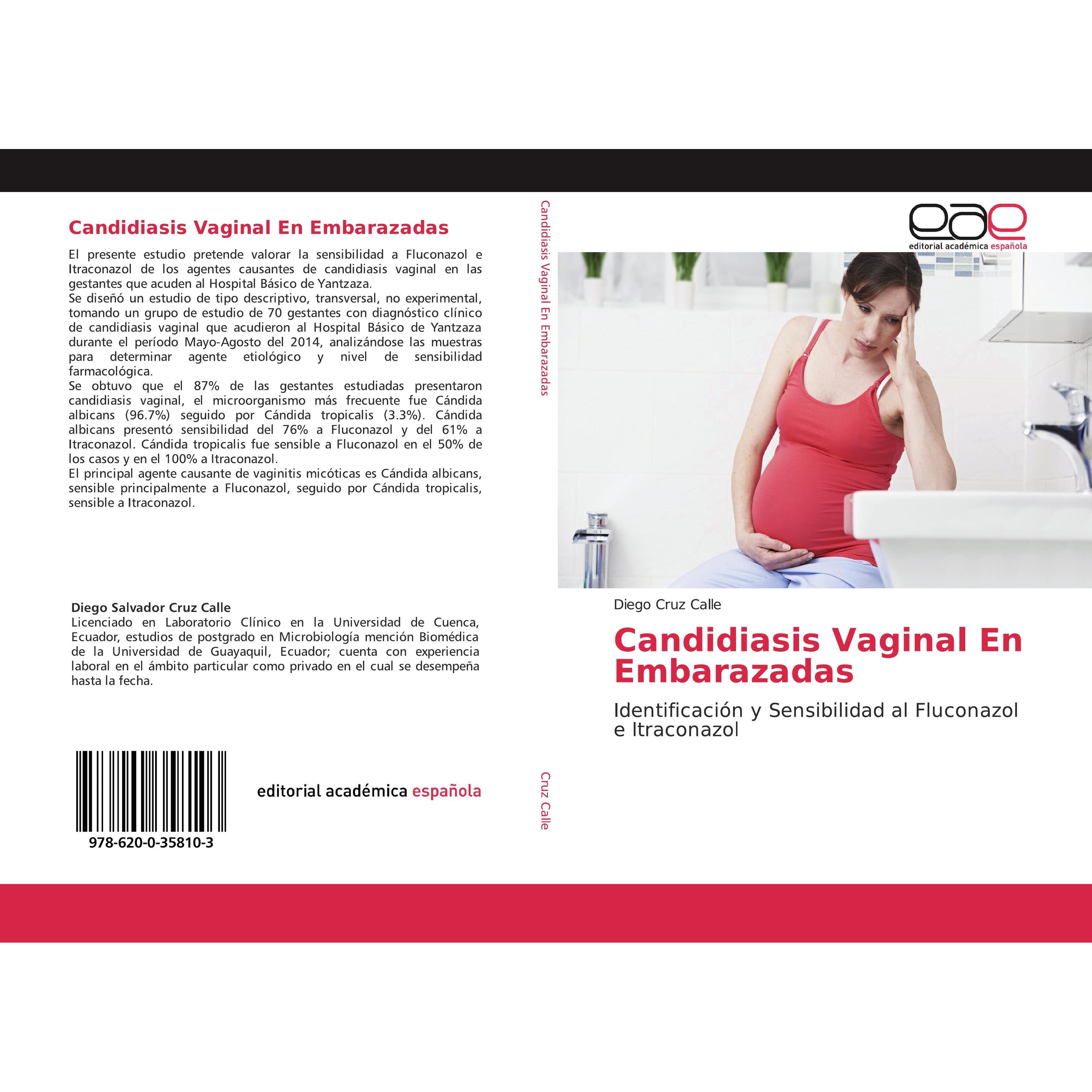 Thumbnail - Candidiasis Vaginal En Embarazadas, Fachbücher von Diego Cruz Calle