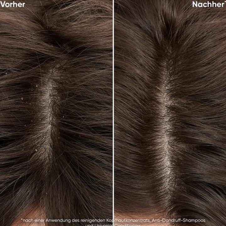 Actual product image Biolage Leave-in Serum for All Hair Types - Absorbs Excess Oil with Fermented Tea 200ml (50 ml)