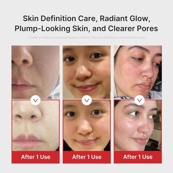 Productafbeelding Medicube Age-R Booster Pro