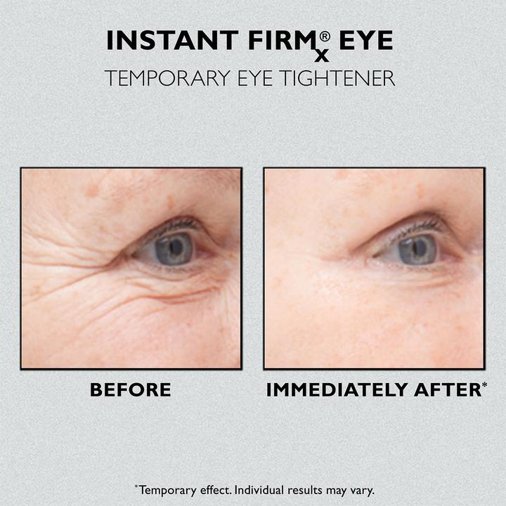 Image du produit Peter Thomas Roth Fermeté instantanée pour les yeux (Gel, 30 ml)