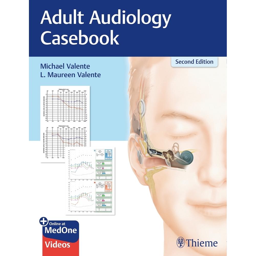 Valente:Adult Audiology Casebook, Sachbücher von L. Maureen Valente, Michael Valente